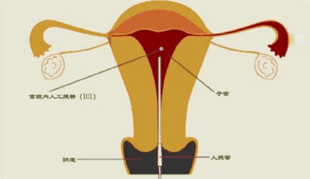 孕妇