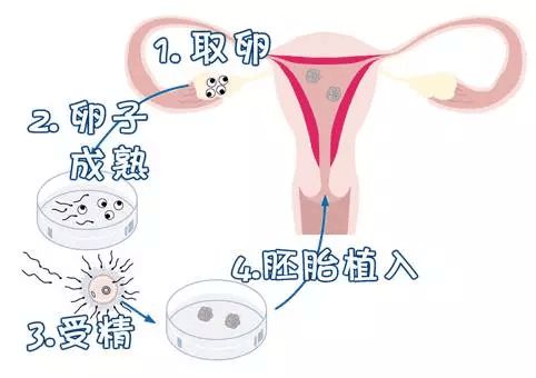 孕妇便秘