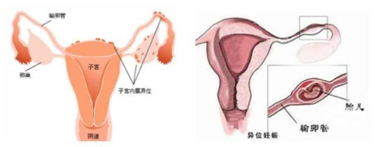 孕妇瑜伽